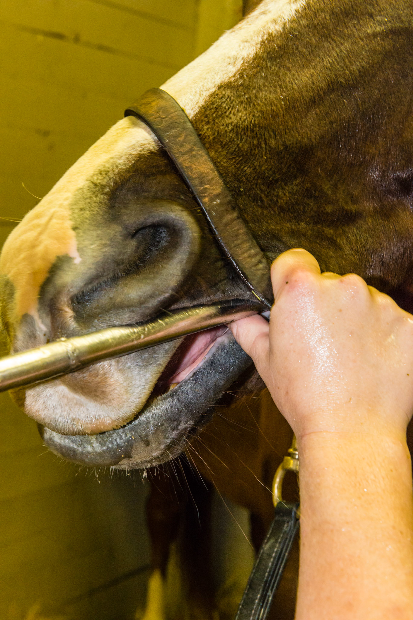 The pool cue technique being used on 207 area. Notice the yaw out position of the shaft as well as the pitch down.  The thumb applies upward pressure of the blade against the teeth.