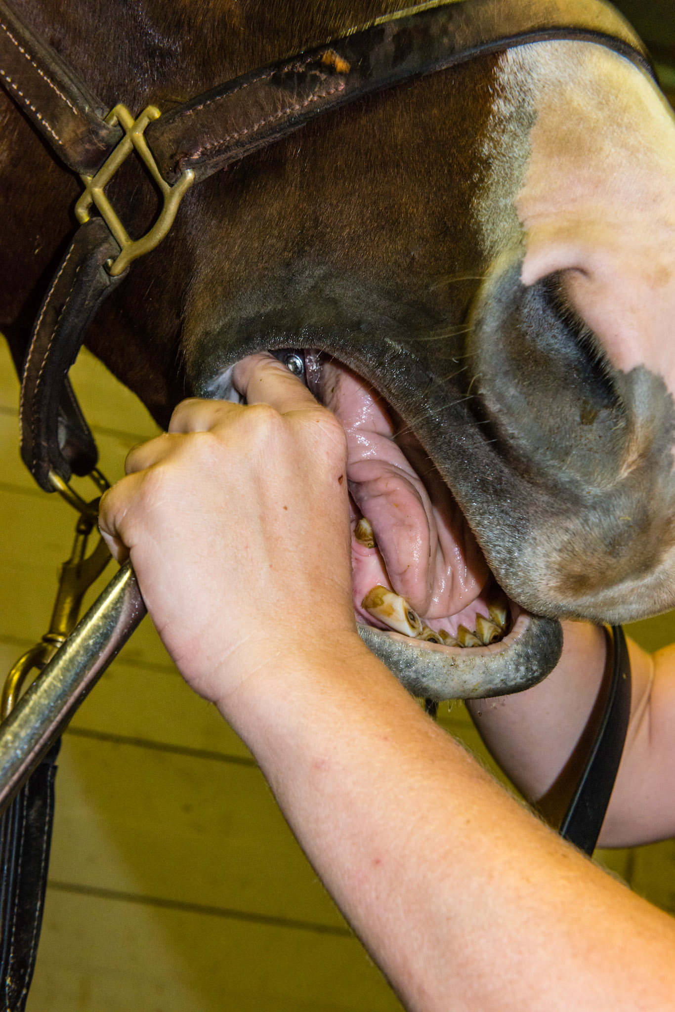 The flabby cheek approach to the lower 6's. Notice the hand is choked up on the shortie. The thumb and forefinger are being used to displace the soft tissue as the hand is gently rotated on the rostral edge of 406.
