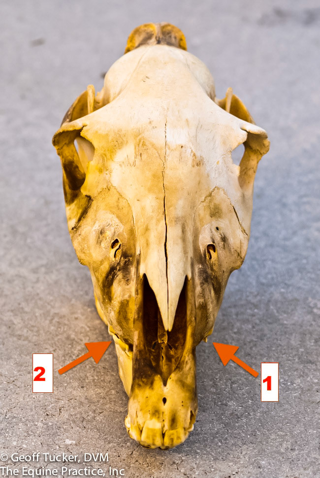 HDS_Anno_Maxillary teeth