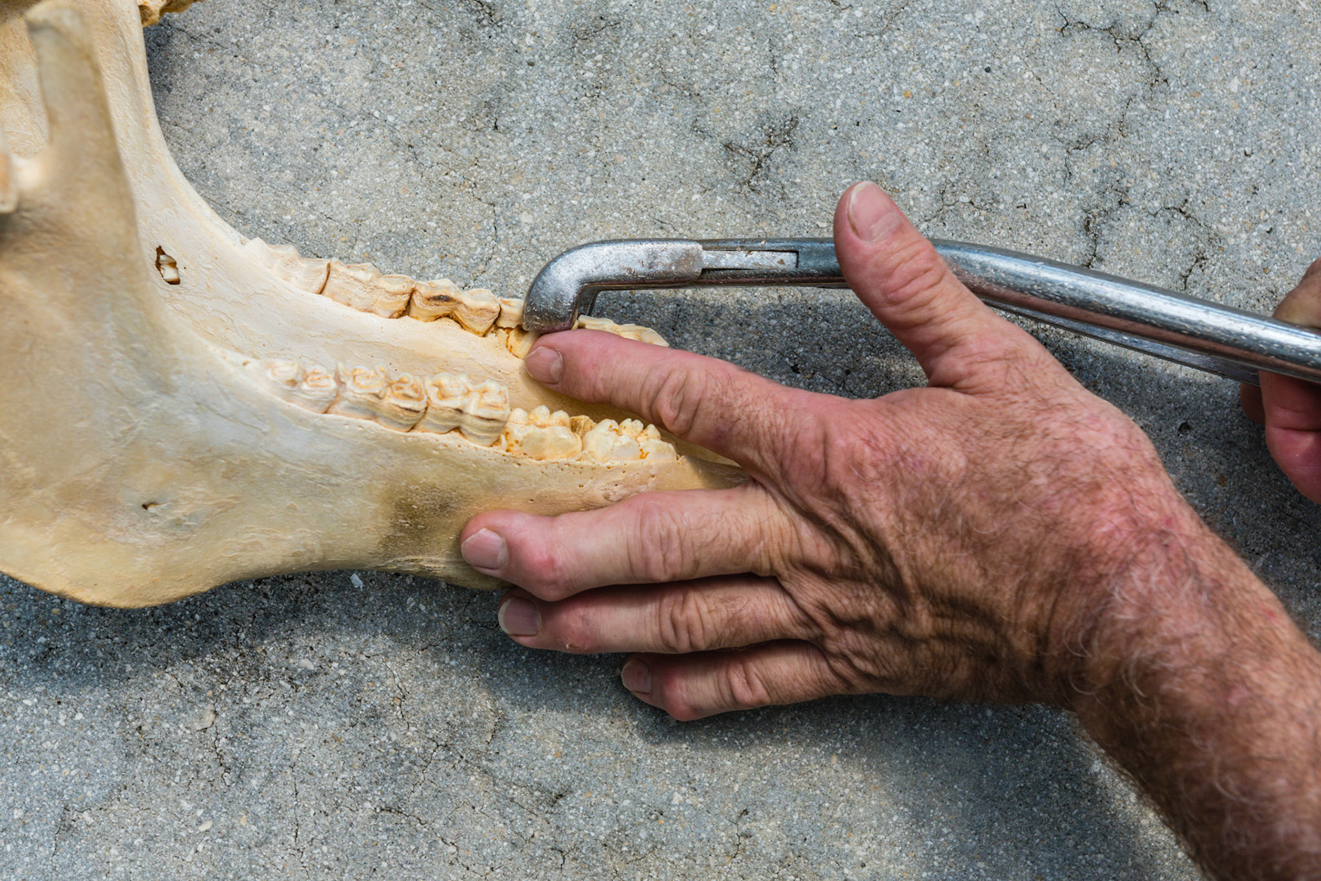 Using the hand in mouth technique, the forefinger can be used to guide the end of the cap forceps onto the correct tooth.