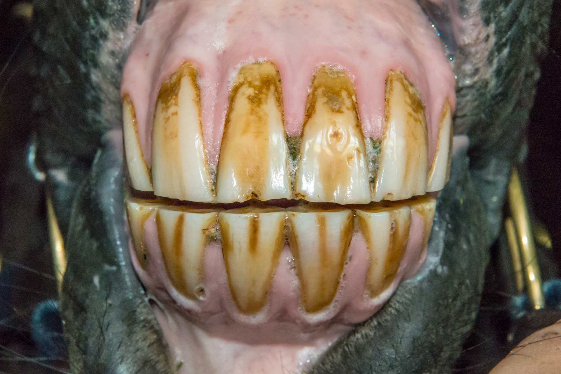 16yr 5mo -  Early stage of EOTRH with  thickening of the gums around the canines, #404 early necrosis, bulbous appearance of incisors. No pain of difficulty in using incisors.