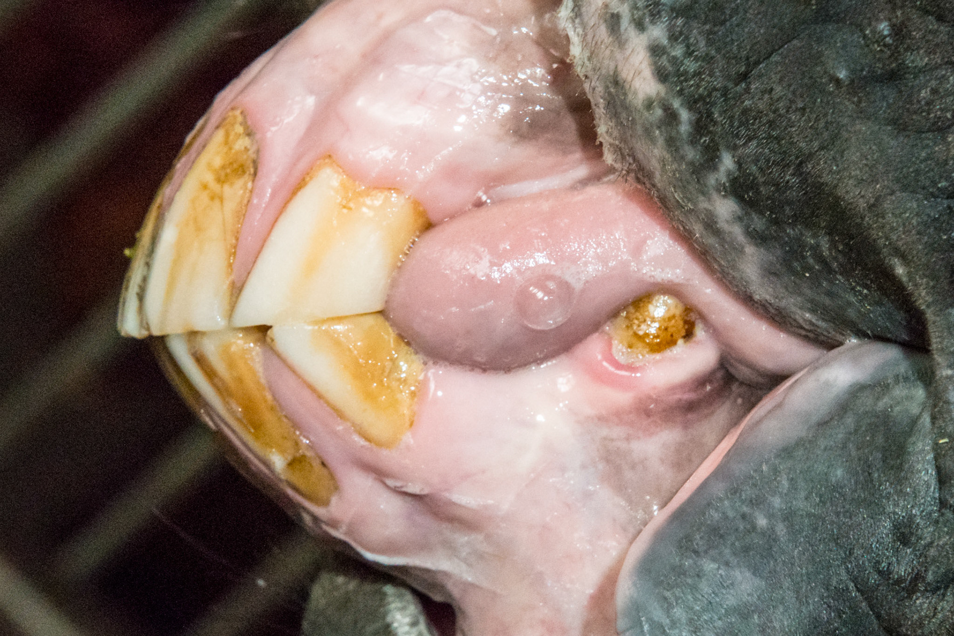 16yr 5mo -  Early stage of EOTRH with  thickening of the gums around the canines, #404 early necrosis, bulbous appearance of incisors. No pain of difficulty in using incisors.