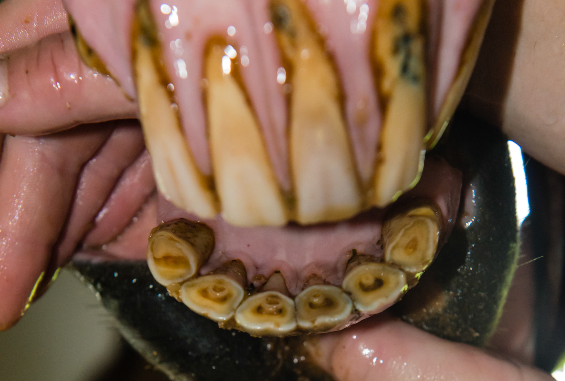 27yr old, EOTRH root enlargement, gum recession, red dots, tooth decay.