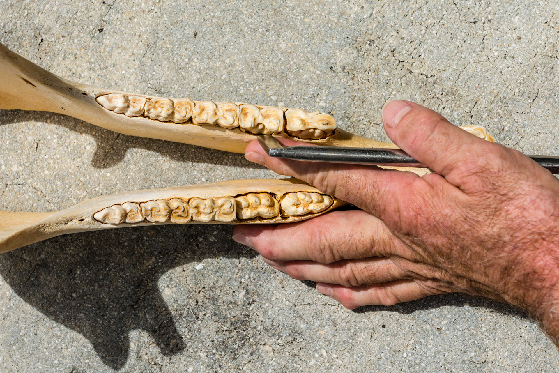 The forefinger guides the parallel pic blade into the lingual side of 307 where it can be driven down into the gum line to remove the cap remnant (not present in the picture).  This technique is also used for removing cheek tooth fragments, especially sagittal fragments.