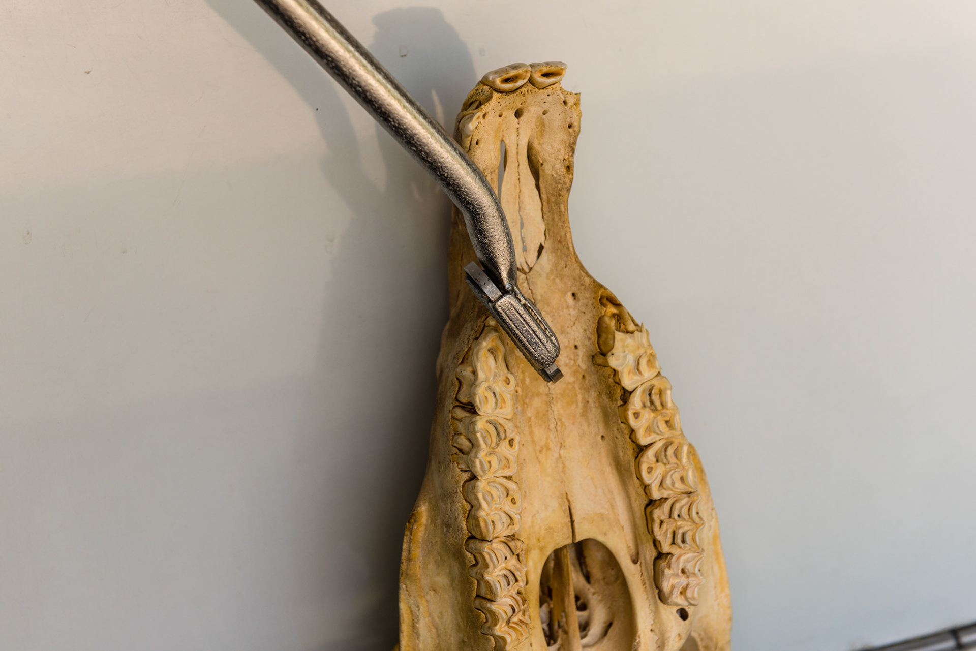 Thge shortie being pushed on the palatal side of the upper 6. Note that the wolf tooth there would rattle if it had been missed in the exam. Also note that it is impossible to round this 6 with the wolf tooth present.