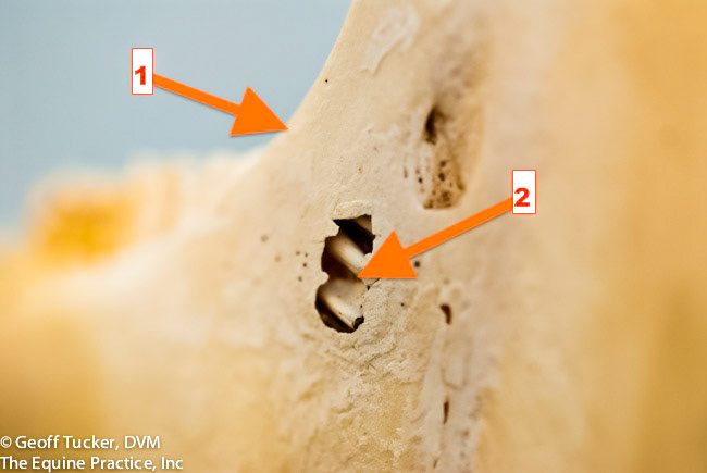 HDS_Anno_Unerupted teeth