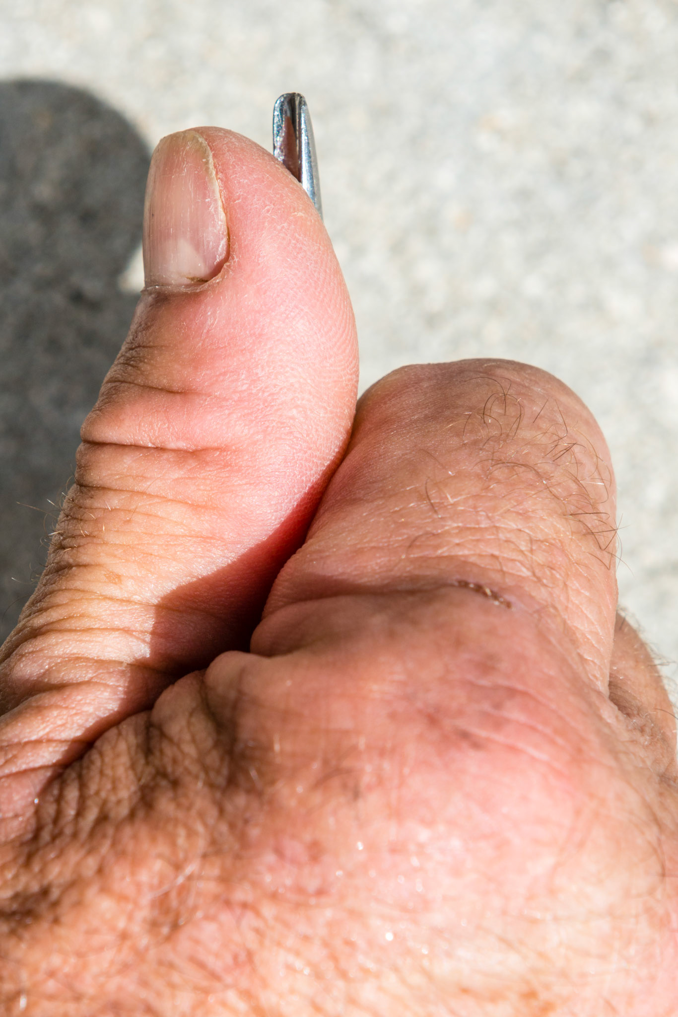 Thumb and elevator tip facing up, closed side of fist.
