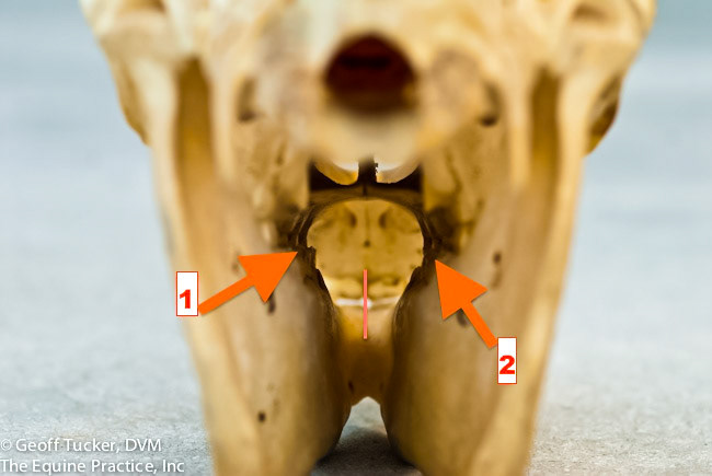 HDS_Anno_Max and Mand teeth