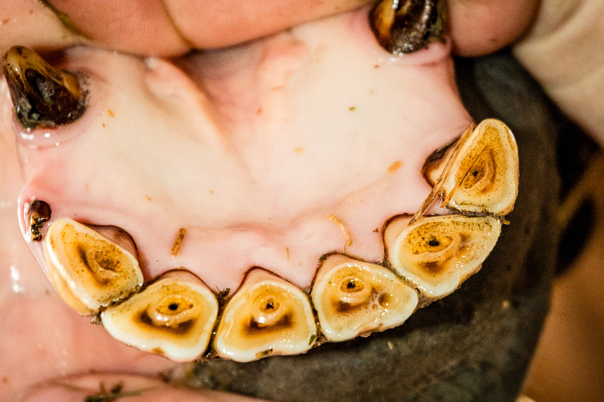 13yr 3mo - incisor cap remnants next to 203 and 403