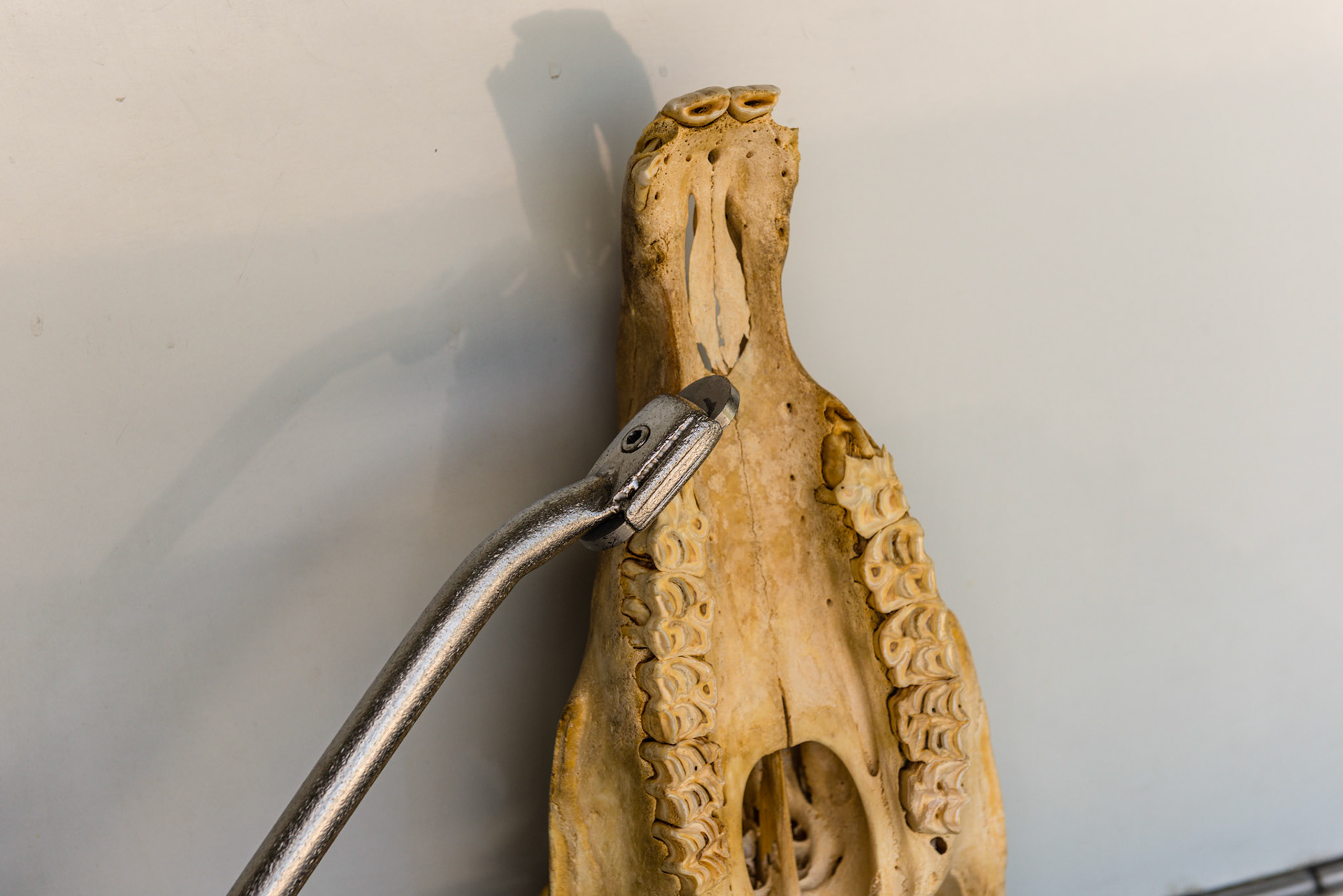 The shortie is yawed out and is rolled towards horizontal to follow the curve of the upper 6. It is now working on the buccal side of the upper 6.