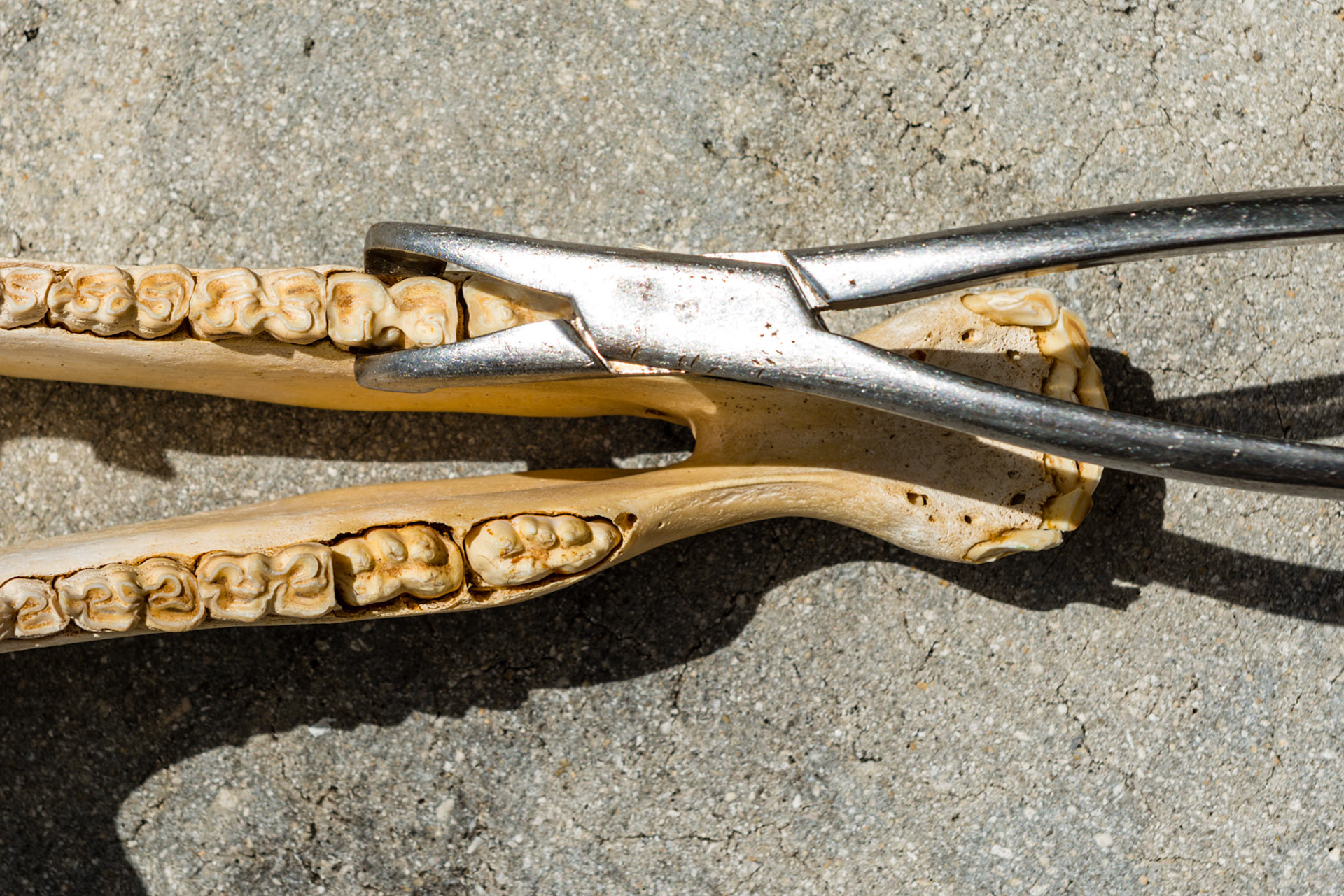 The lower Reynolds cap forceps on 77.