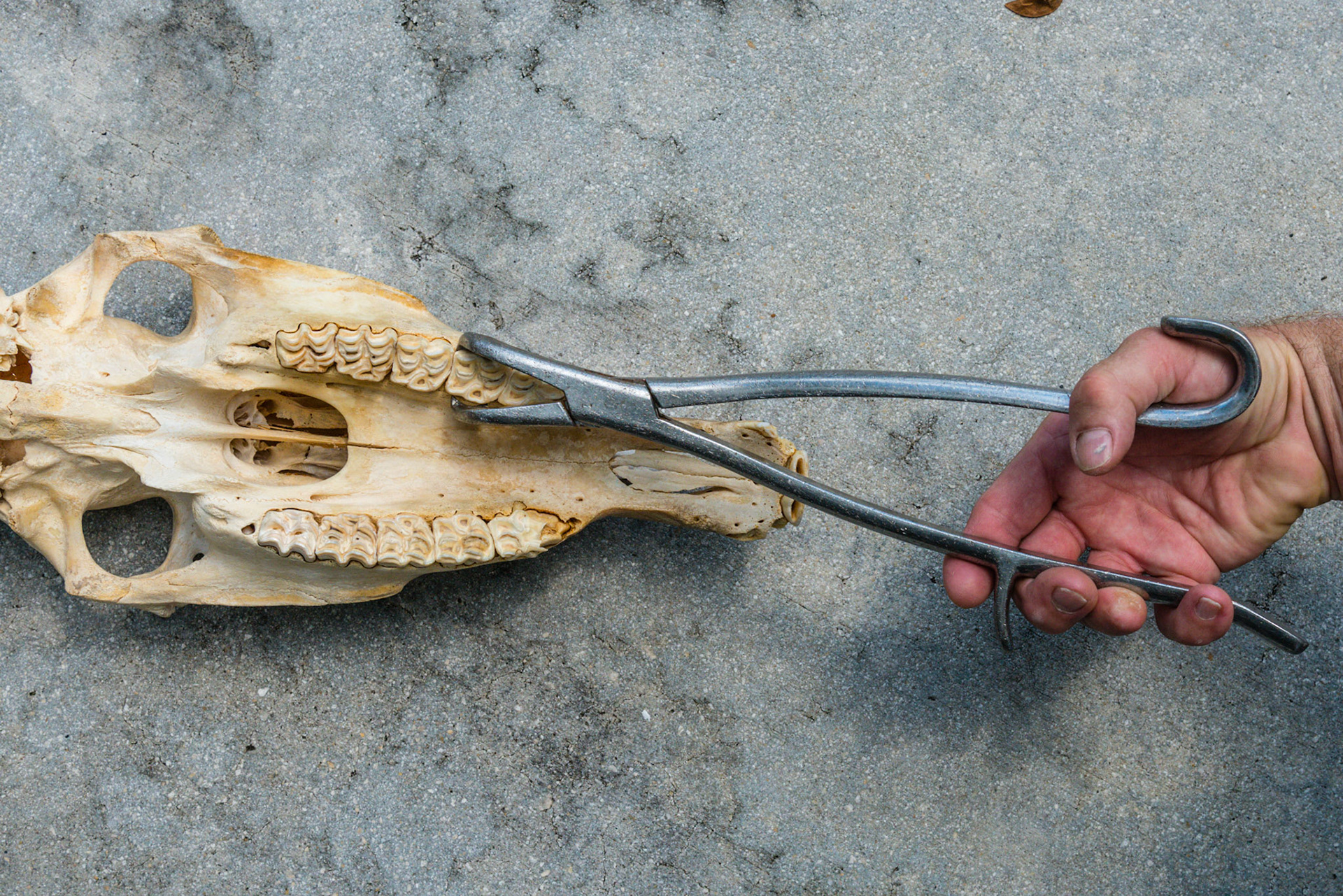 The upper Reynolds cap forceps applied to the 57 cap. Notice how the hand is applied to the forceps. The tab on the handle allows you to push and pull the forceps in the mouth without having to grip the handle and close the jaws. The hook end of the handle also hooks onto the thumb. These added features of the Reynolds forceps also help when rotating the forceps to rock the cap off.