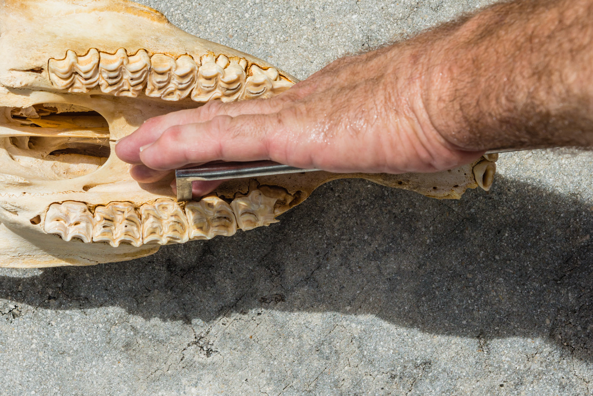 Using the hand in mouth technique, the forefinger can guide the dental pic to the cap remnant or the cheek tooth fragment. The parallel tip works best for cap remnants and displacing sagittal fracture pieces. It can also hook any of these and pull the fragment from its position.