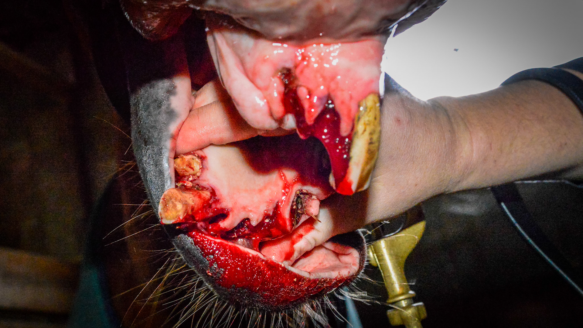 ETORH horse 5 - with loose, painful, &amp; necrotic incisors. Excessive tartar due to tongue not moving over the painful teeth. Extracted with IV sedation and analgesics. Horse went right to eating without difficulties afterwards.