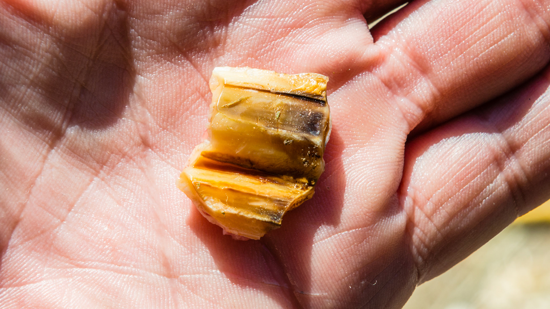 #208 buccal sagittal fracture seen removen in video 140908_extract fractured piece. Medial side is the side where the decay formed splitting off this segment.