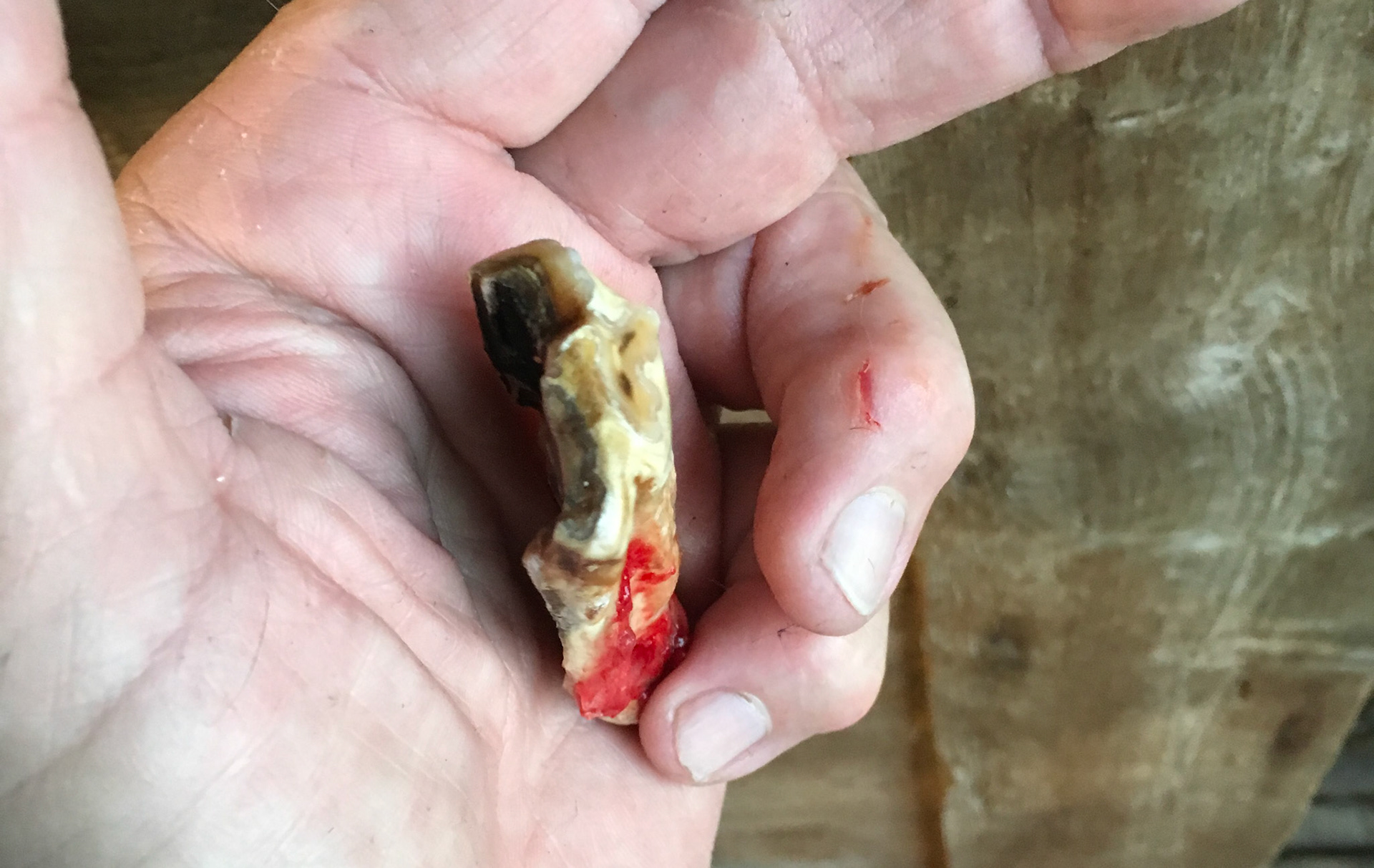 Large cheek tooth fracture shows the black decay that caused the saggital split.