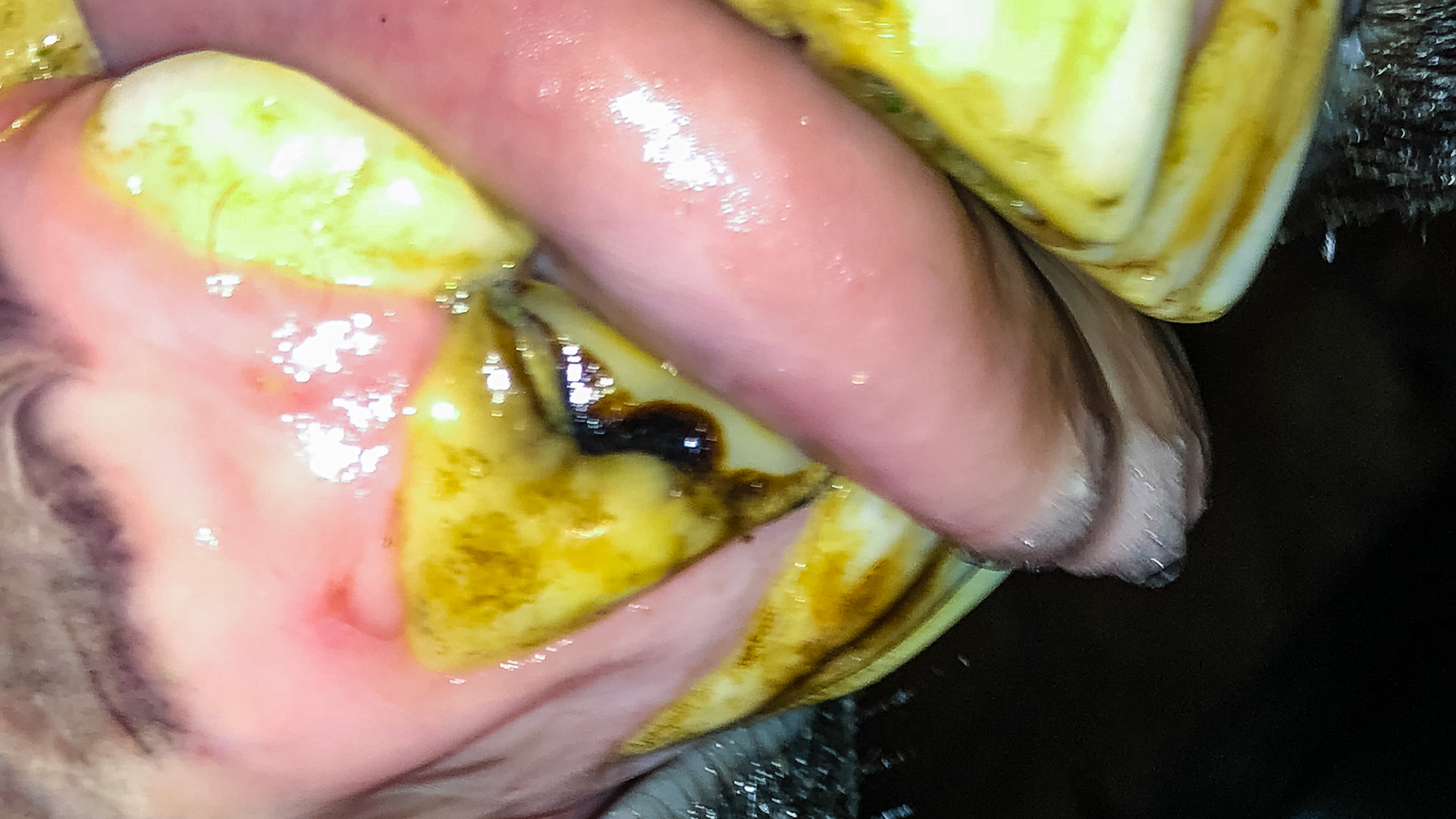 Cap 802 sits on top of the underlying permanent tooth awaiting its turn to be shed.