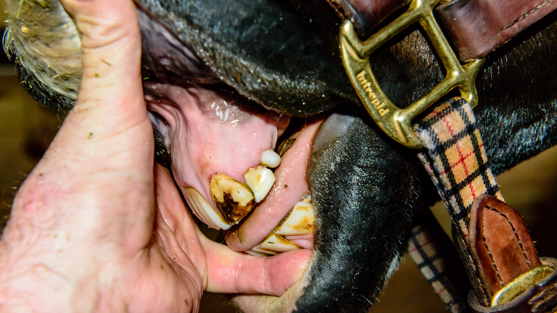 An absent 203, a retained decidulous cap remains and the upper canine has erupted next to the corner incisor cap.