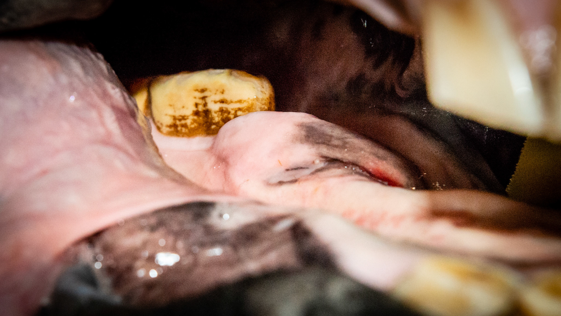 This is #306 with a firm callous mass rostral to the tooth.  This horse was not painful or protective of this area and the tooth was easily floated.