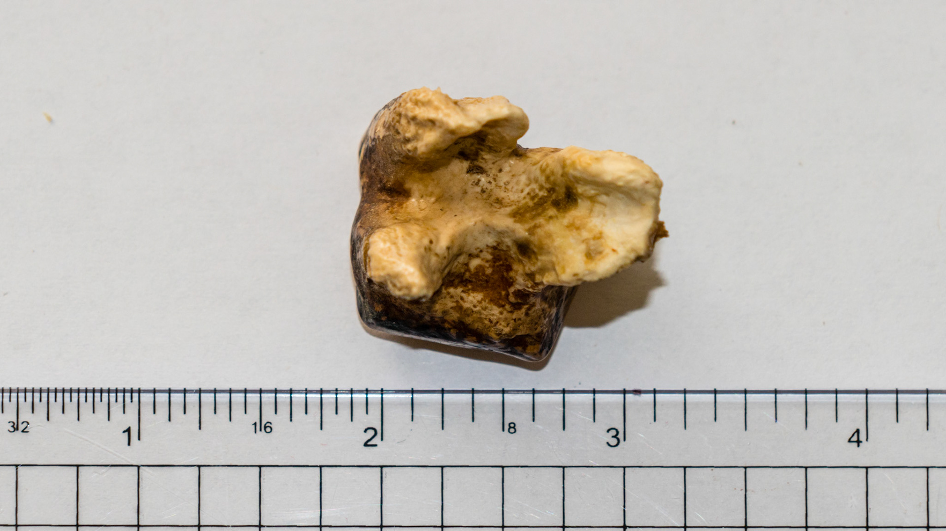 Several views of an end stage cheek tooth.  This tooth was extracted by hand and was more of an annoyance to the horse than painful.