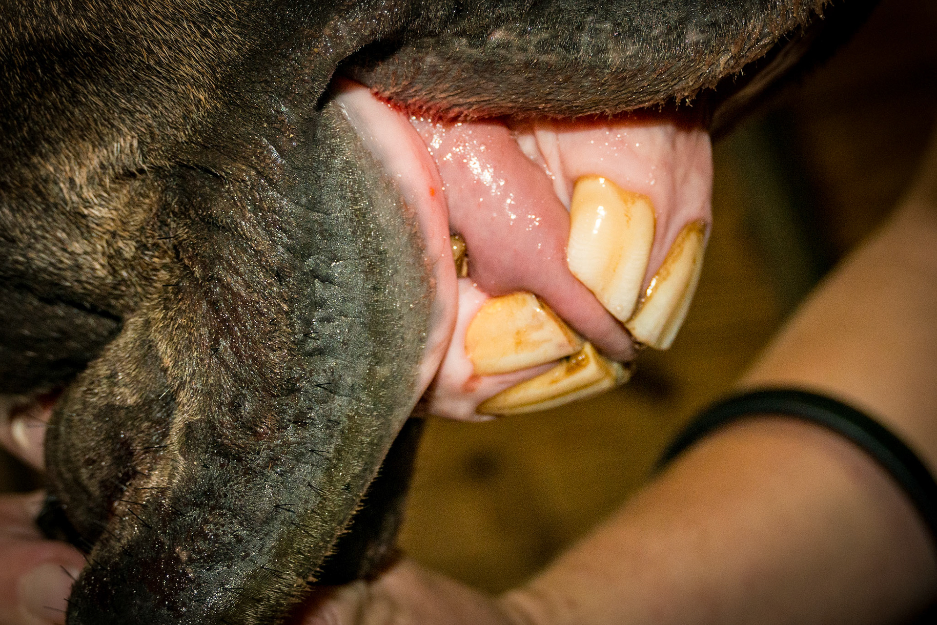 21yr 2mo - with relaxed incisors in a natural position