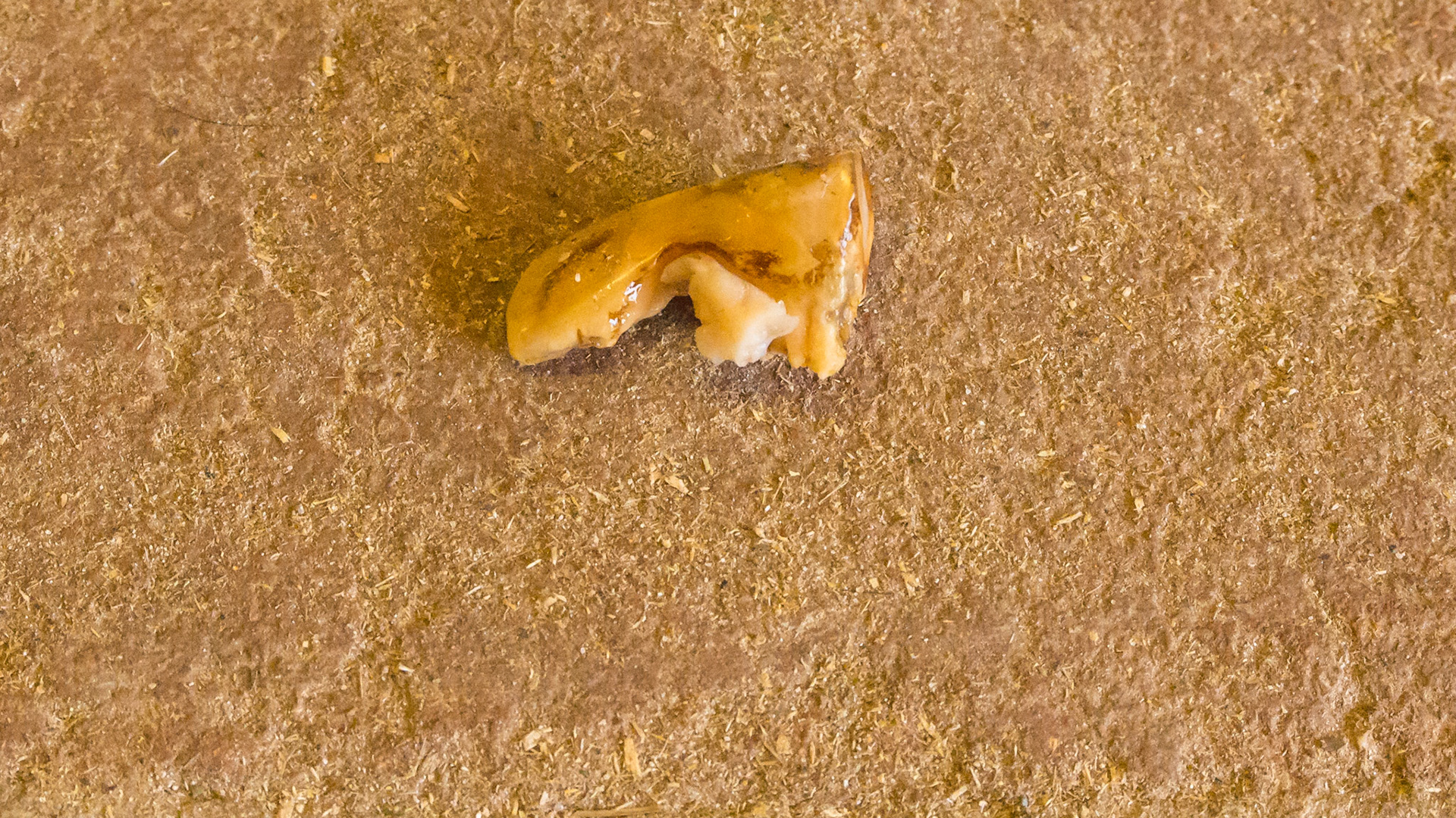 End stage #406 from a 28 year old