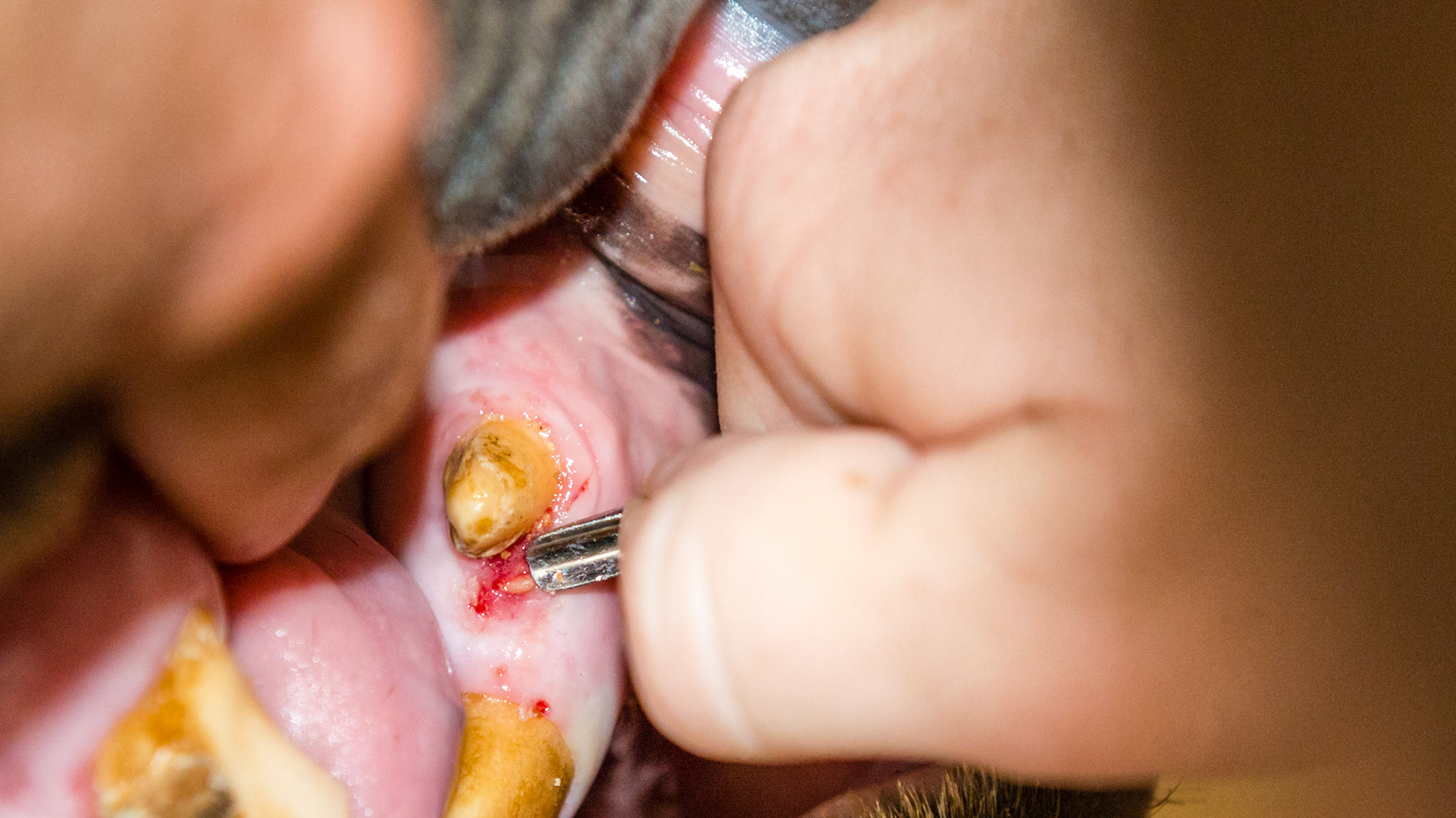 A tooth fragment rostral to 304 with gum irritation. Removing using the wolf tooth elevator. 2 of 3