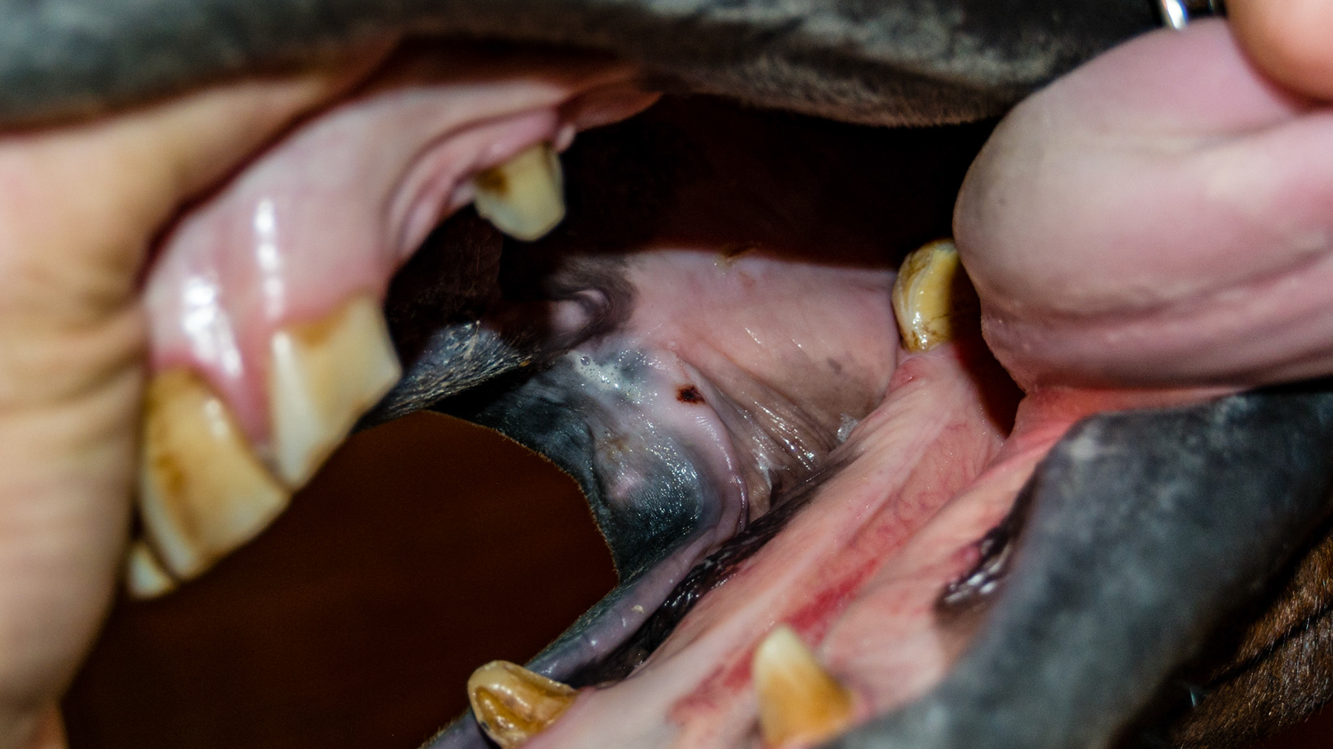 Small hematoma at the right lip corner