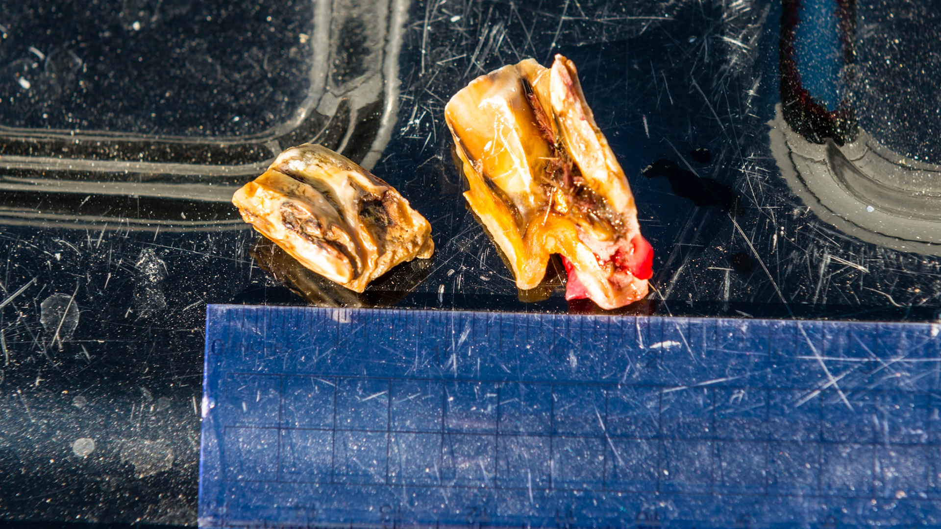 2 separate fracture pieces removed one at a time from 108. No drugs needed for removal. Horse showed great relief.