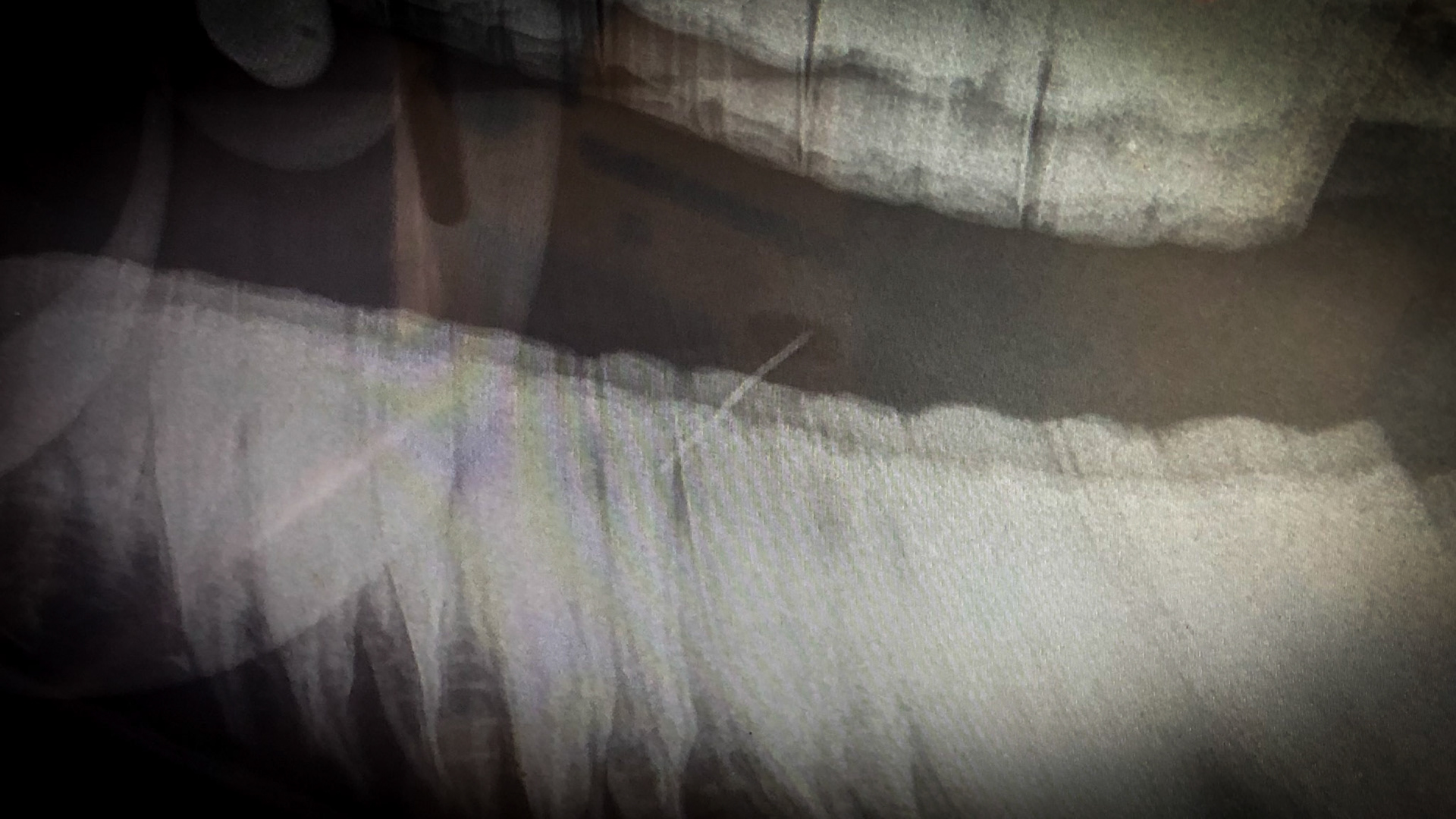Needle horse - An X-ray of this horse shows a thin white line within the soft tissue of the (dark gray) tongue.