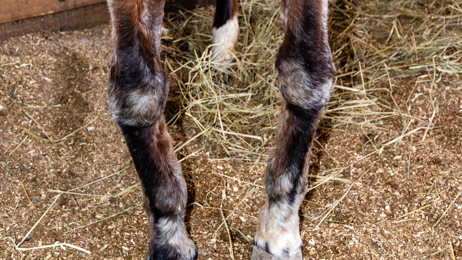 Ankylosis of both knees in a 28 yr old