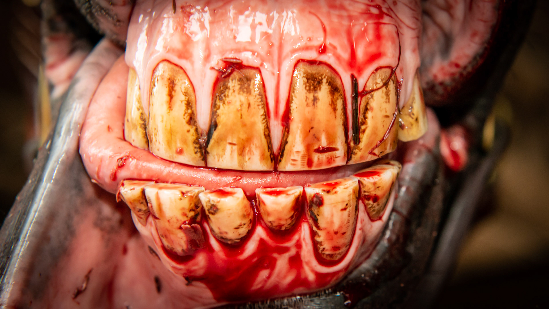 This rescued horse required medication for pain. The 307 &amp; 308 were decayed and completely eliminated except 1 remaining fracture piece which was extracted with moderate blood loss. The tongue rests to his right side naturally. The lower jaw was undershot and had 7 incisors that were abnormal in size.