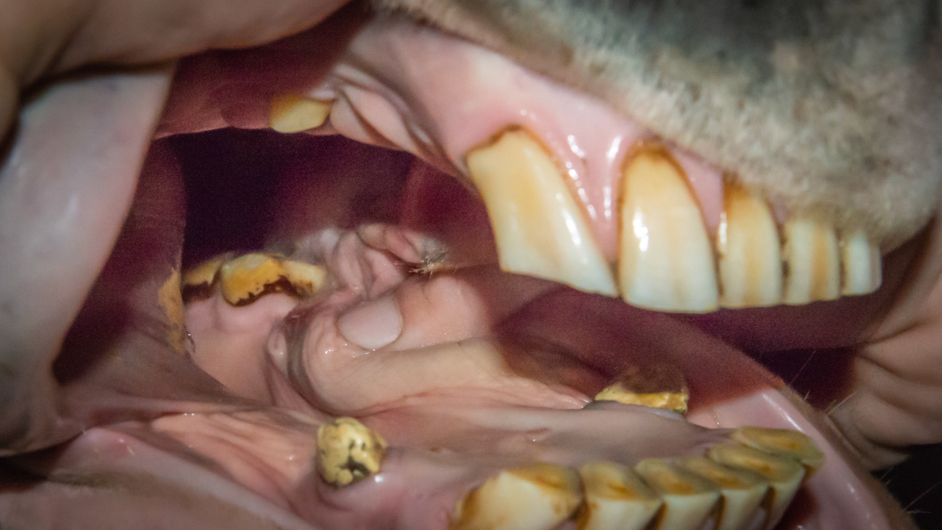 The thumb is pressing down and starting its push caudally towards the tooth