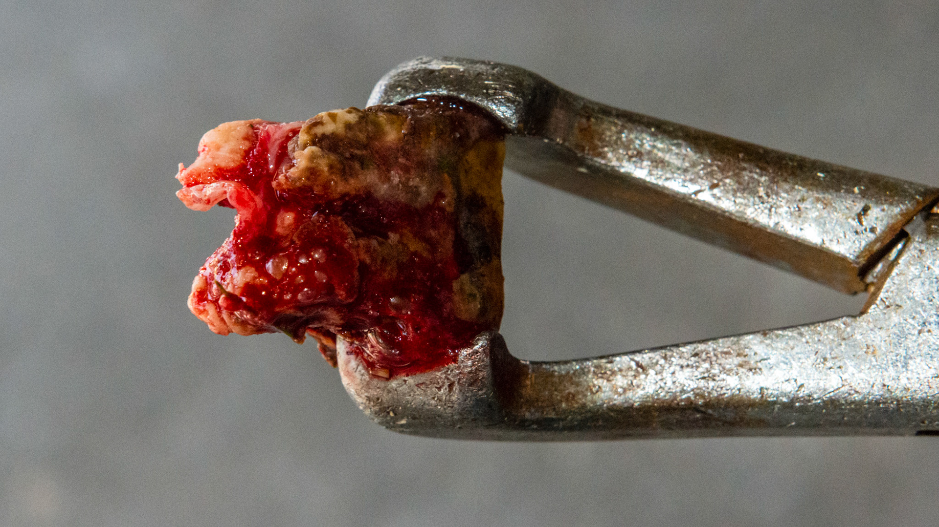 #211 in a 24 year old pony. Malodor and loose when filed. Non-painful and was extracted with these upper cap pullers without any pain medication. Extracted because of odor and he had already lost 111 and 110 and he lives a day away.