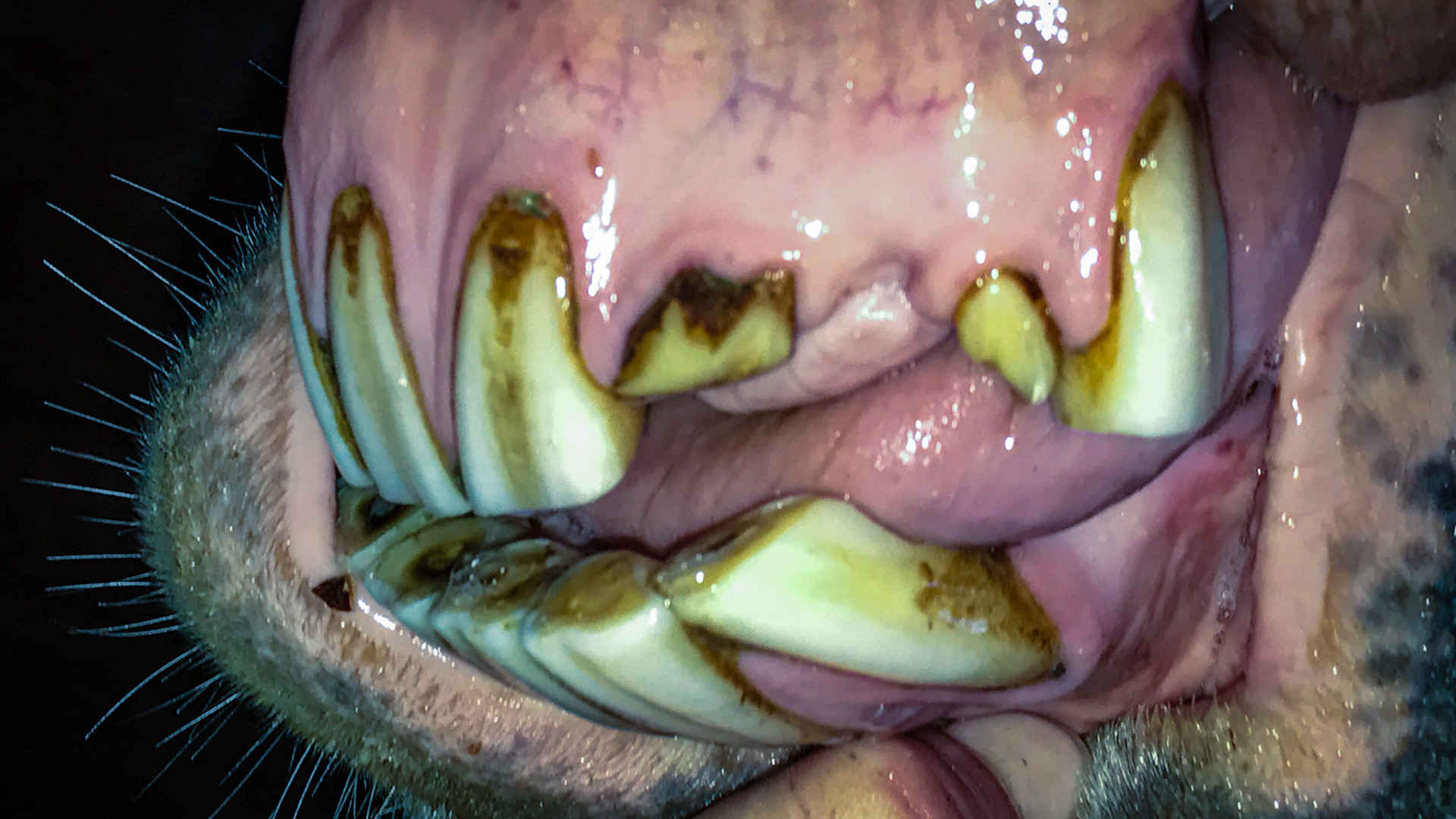 Missing and displaced upper left incisors.