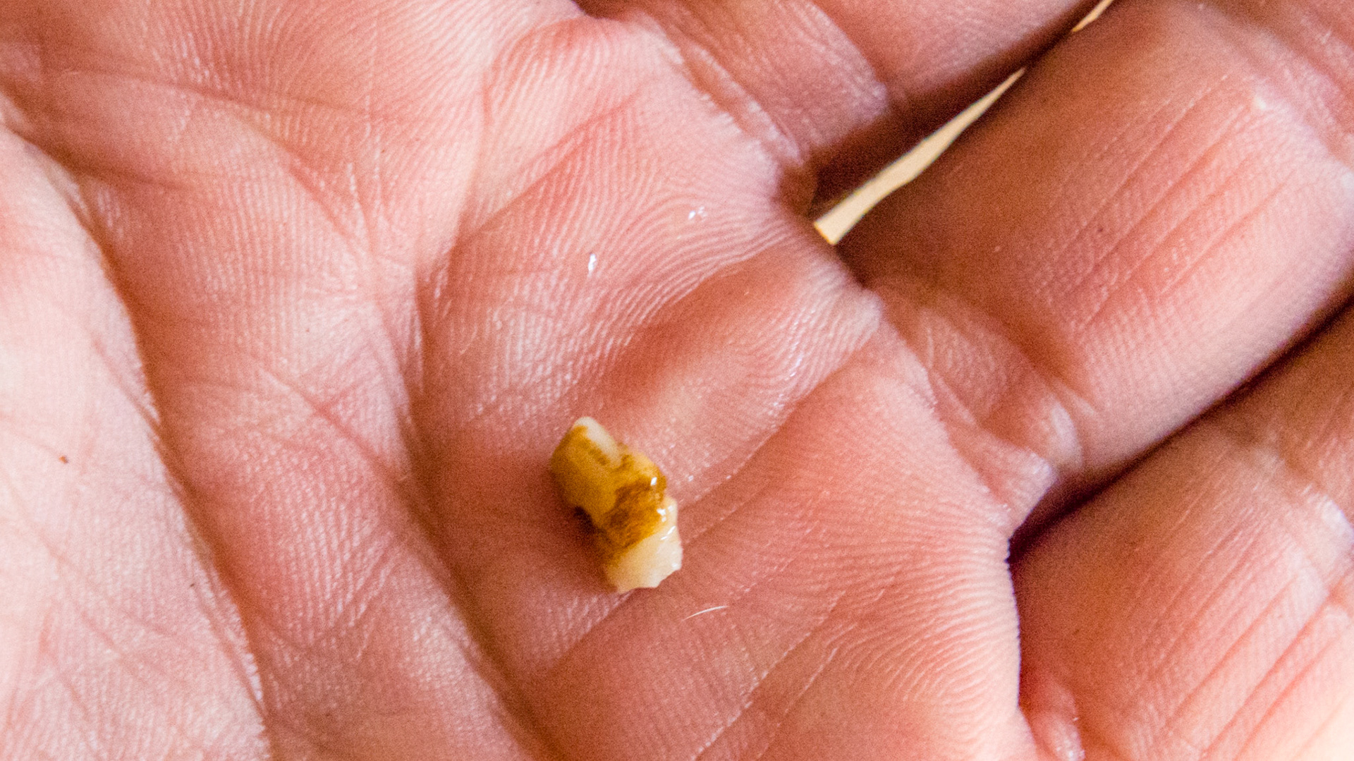 105 Wolf tooth in a 7 year old pony. 1 of 2 views