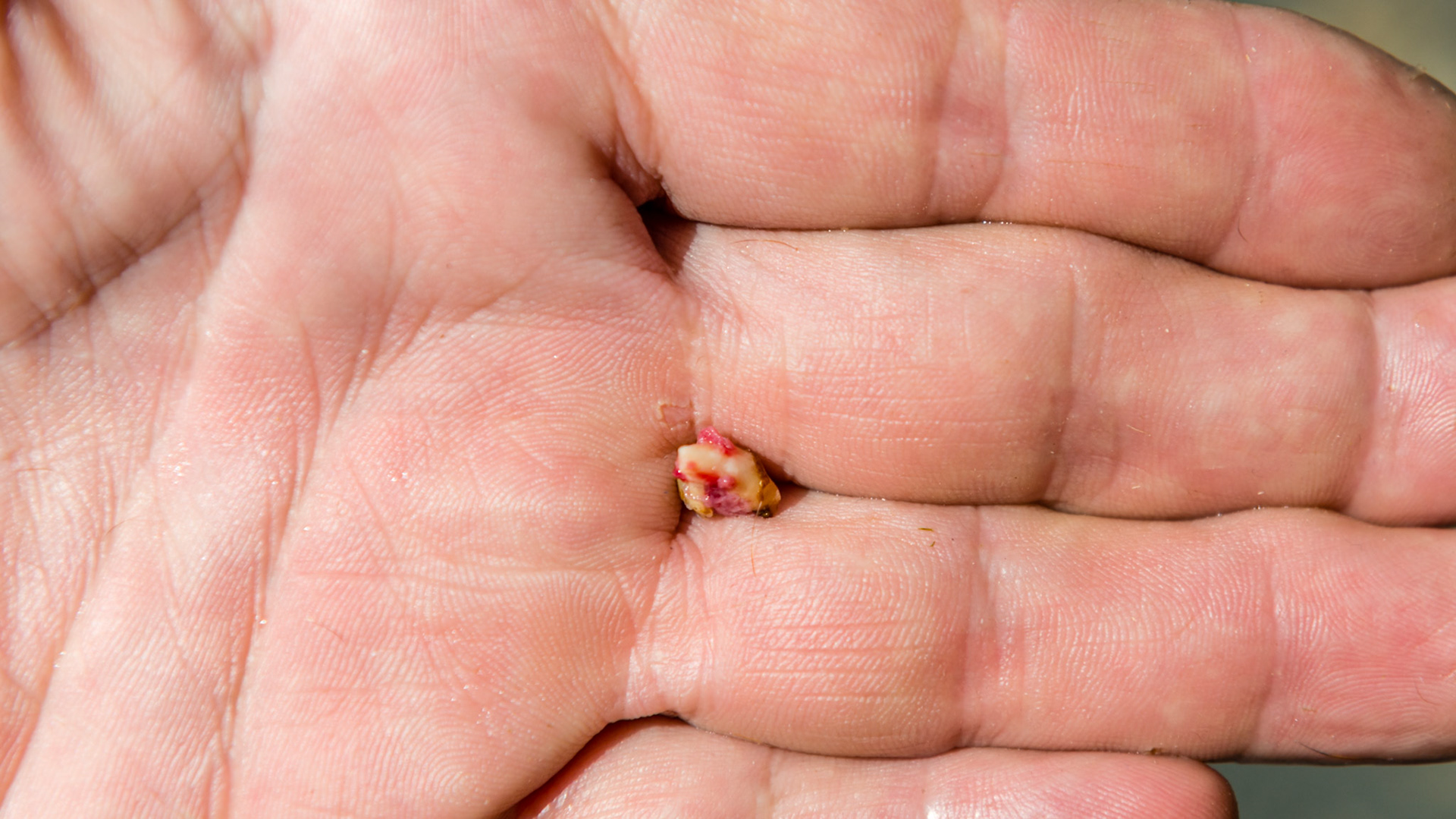 This cap remnant was found firmly attached to the of 408 lingual gum line of a 6 year old warmblood.  No drugs were needed because this horse had no pain associated with the extraction. The parallel dental pick was used to lever it out.