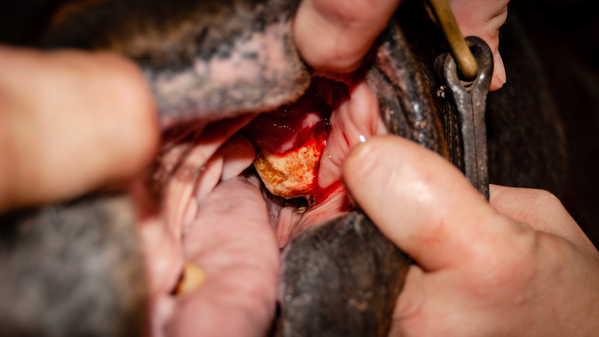 Most of the calculus is removed. The blood is from the gum inflammation under the calculus.