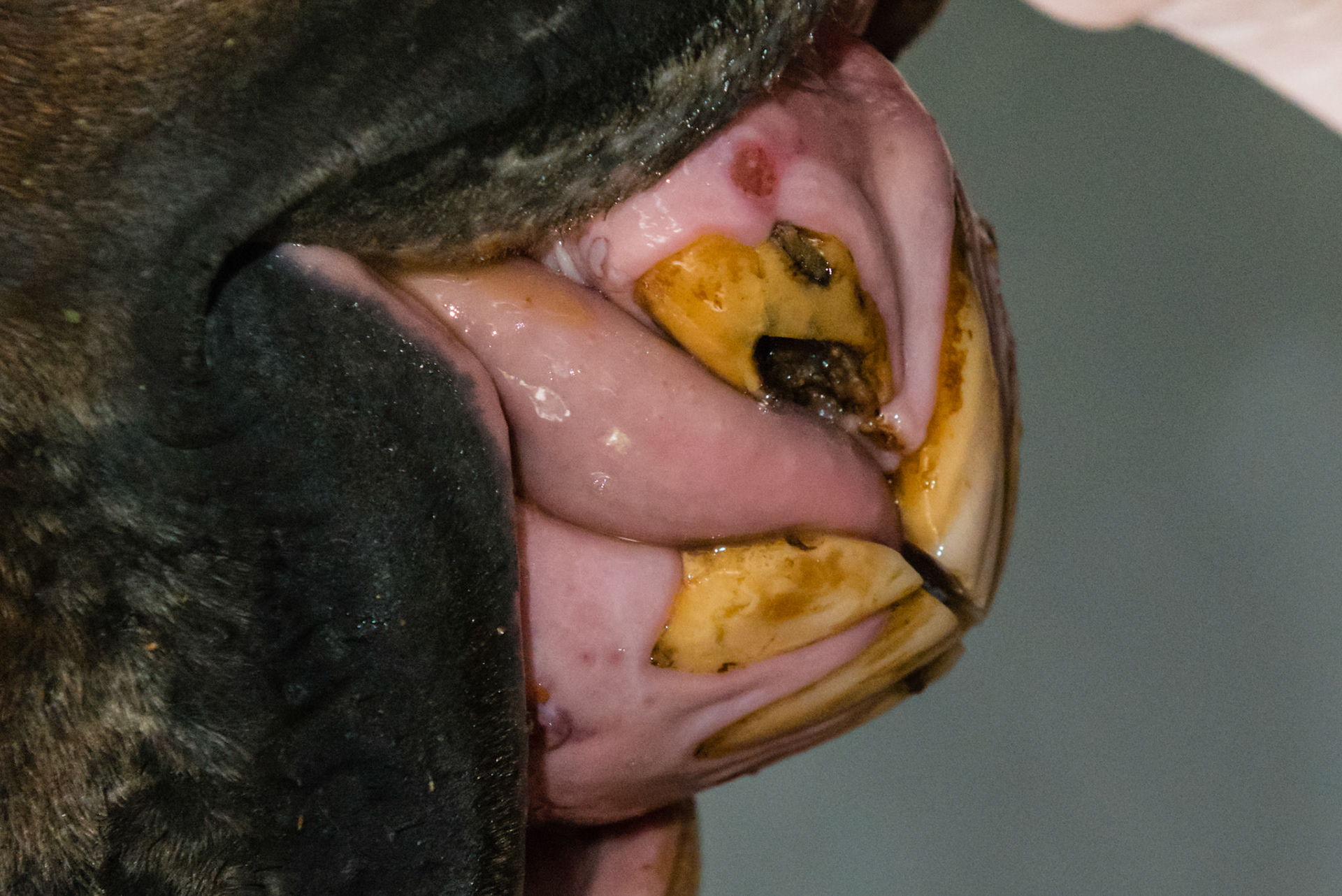 27yr old, EOTRH root enlargement, gum recession, red dots, tooth decay.