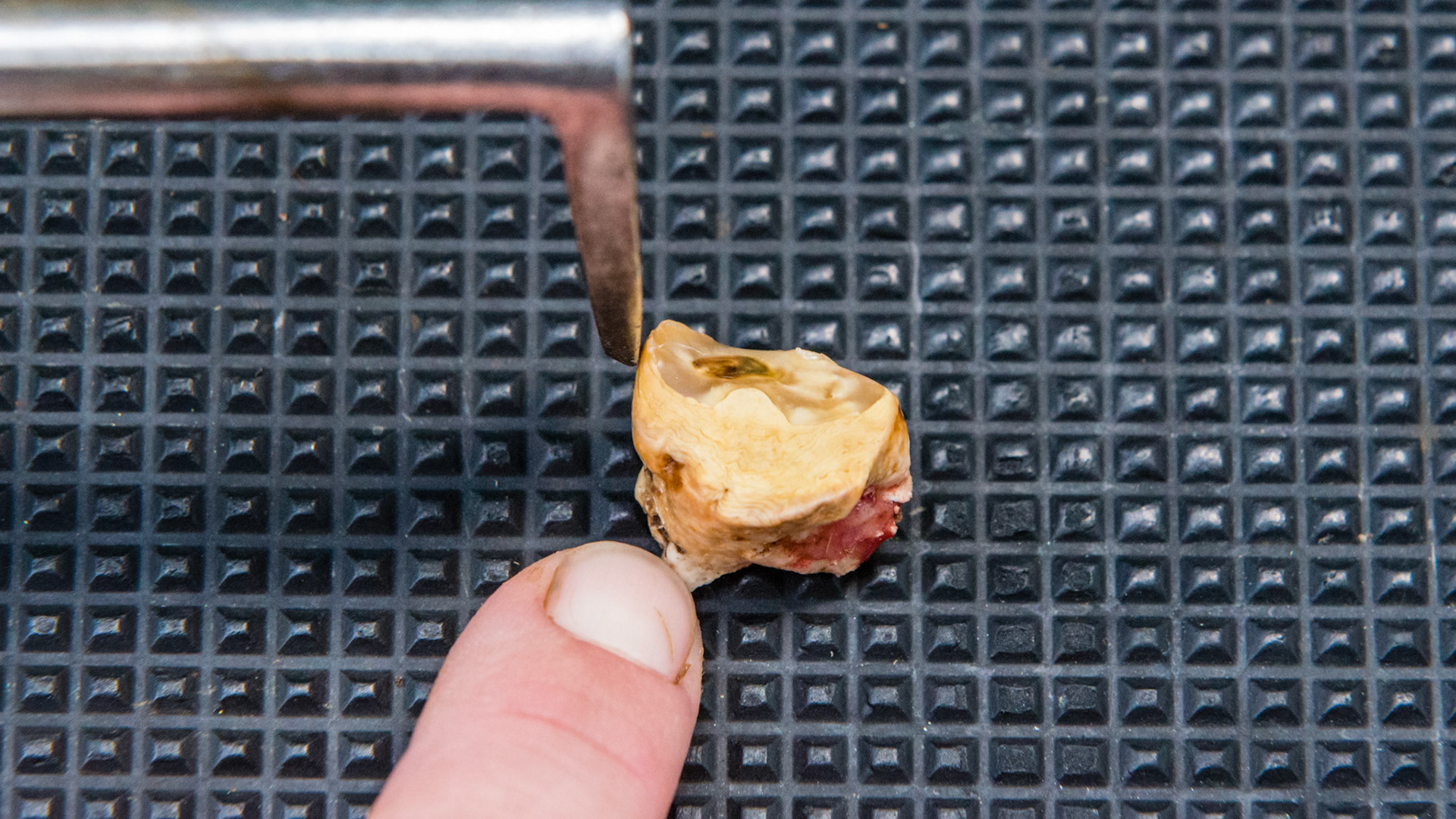 408 medial sagittal and transverse tooth fragment in a 28 year old. The lingual side faces the hand. The dental pic was placed between 407 and the tooth fragment. Pressing caudally, the fragment was displaced medially and was then grabbed with the fingers. It was only attached by the tag of gum tissue seen on the caudal and distal part of the fragment.