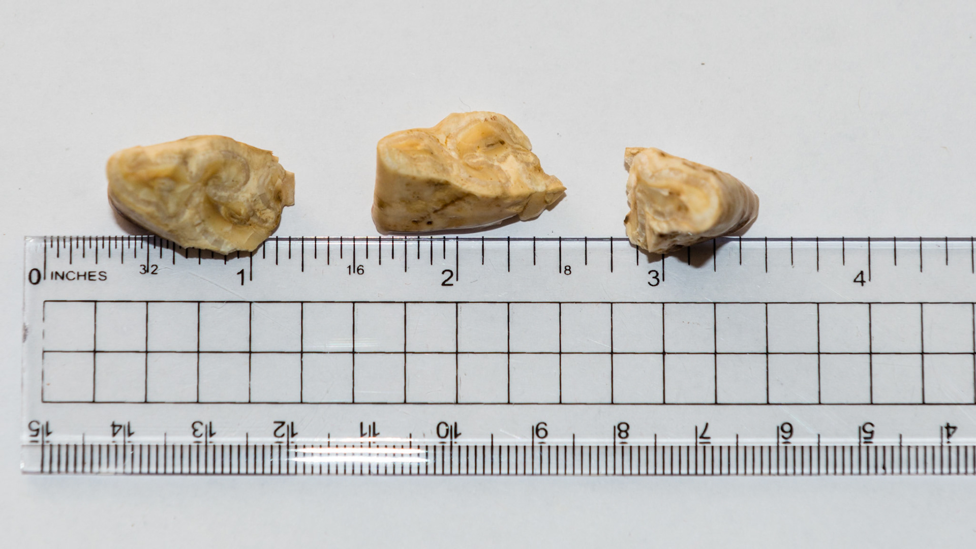 These are 3 over-erupted last lower cheek teeth called caudal hooks. The cut surface is now level with the occlusal surface of the arcade. These hooks caused discomfort in the horse when bridled.