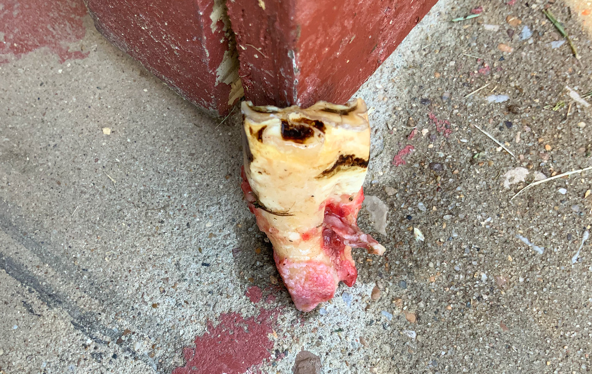 Palatal sagittal fracture that ran the length of this 209.  Difficule to remove this displaced piece in a 20 year old horse.  The year before she had a mirror image fracture of 106.