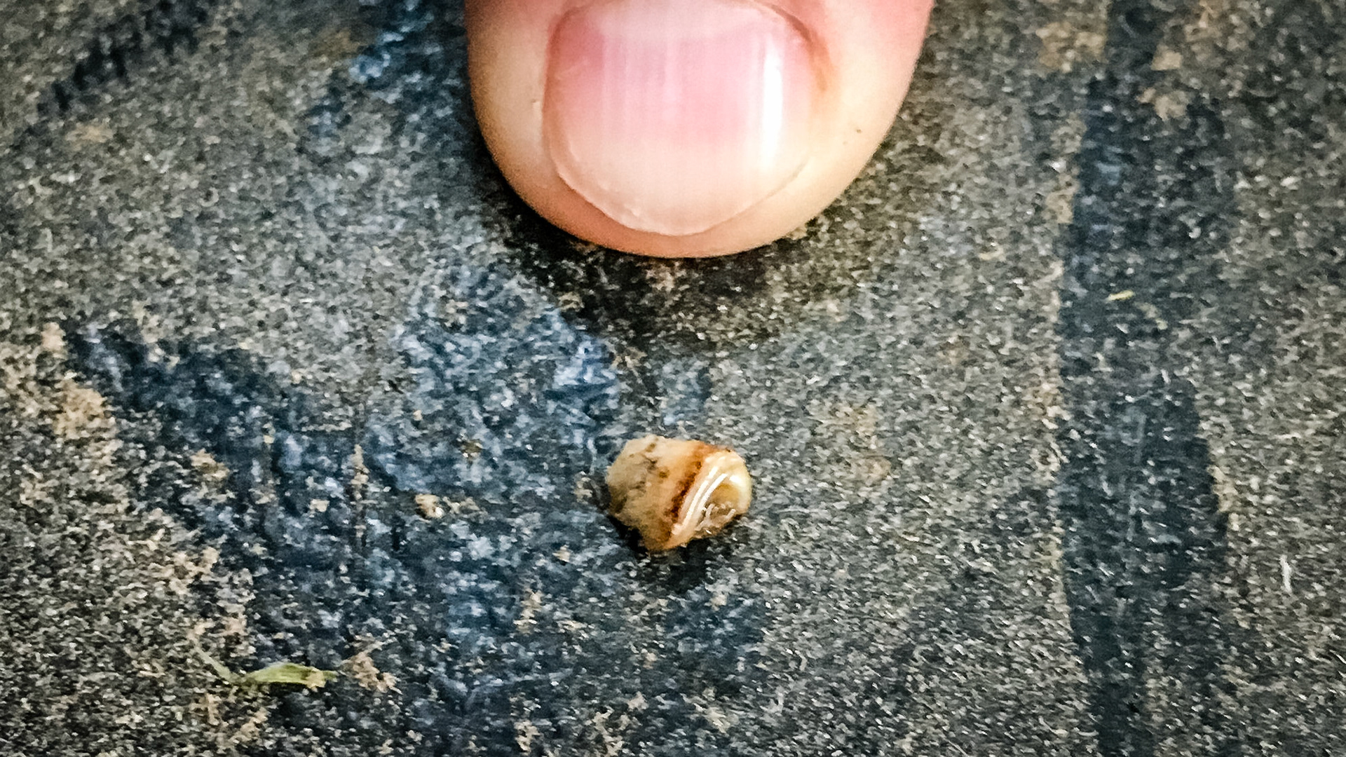 cap remnant but not sure