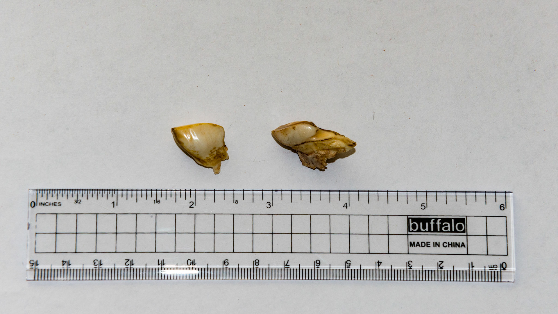 These incisor caps have excessive roots that look more like alveolar bone. Caps like these often remain attached displacing the underlying permanent incisor and requiring extraction by the dentist.