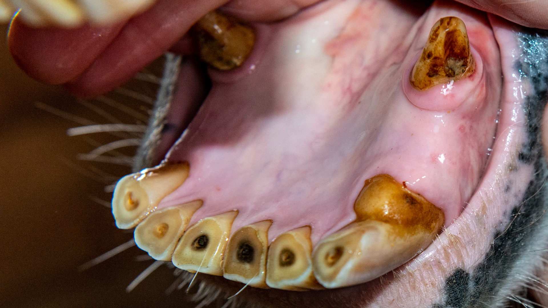 A malformed #303 with receeding gum line in a 24 year old with suspected EOTRH (more evident in the upper incisors). Also necrosis of the pulp chambers of 301 and 401.