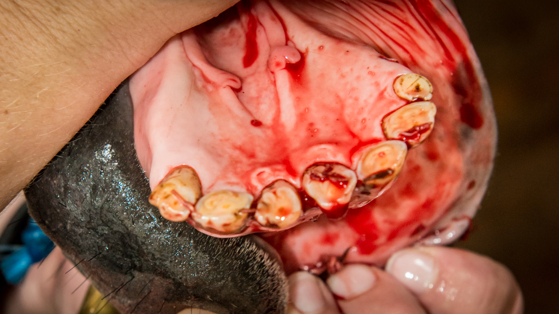 This rescued horse required medication for pain. The 307 &amp; 308 were decayed and completely eliminated except 1 remaining fracture piece which was extracted with moderate blood loss. The tongue rest to his right side naturally. The lower jaw was undershot and had 7 incisors that were abnormal in size.