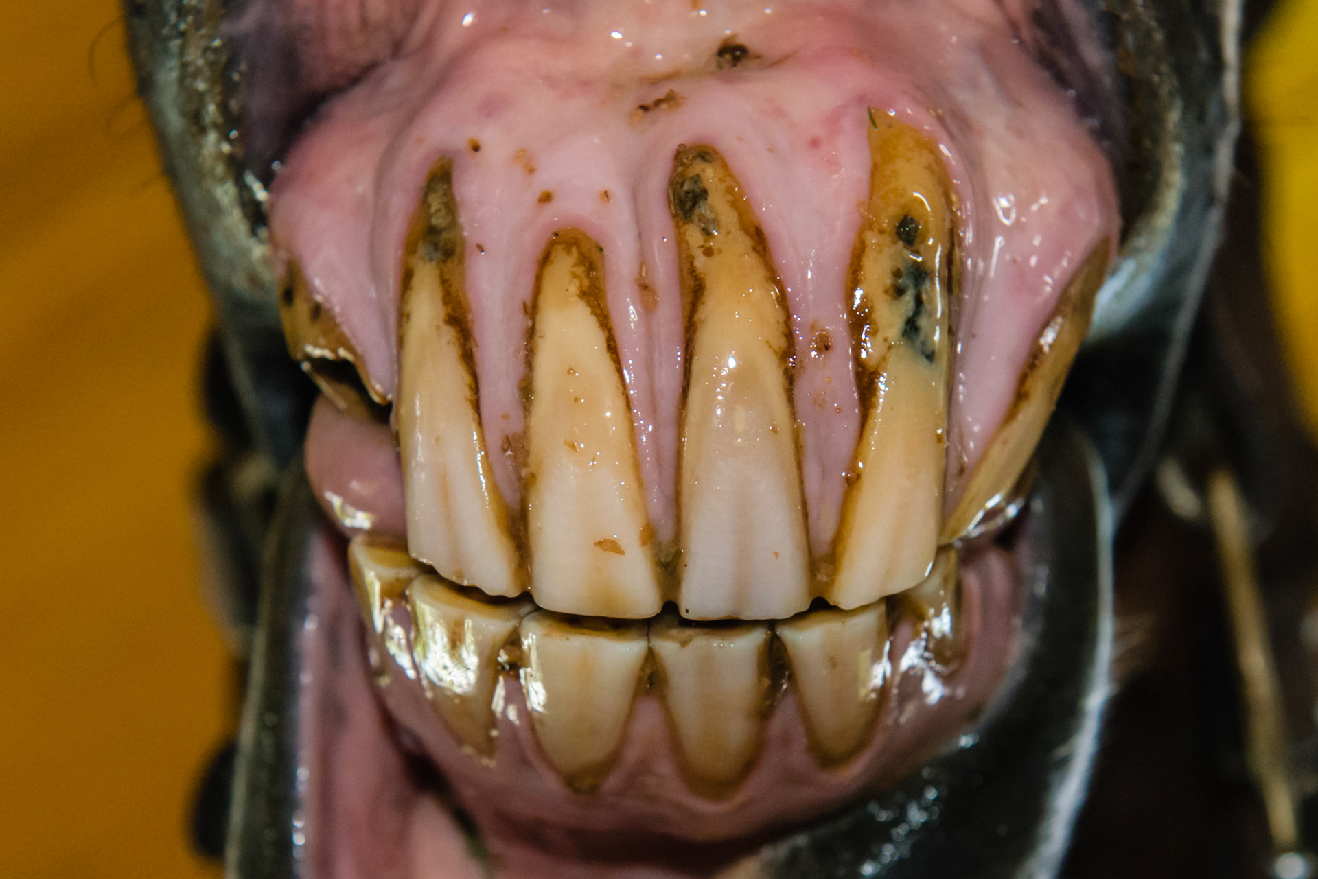 27yr old, EOTRH root enlargement, gum recession, red dots, tooth decay.