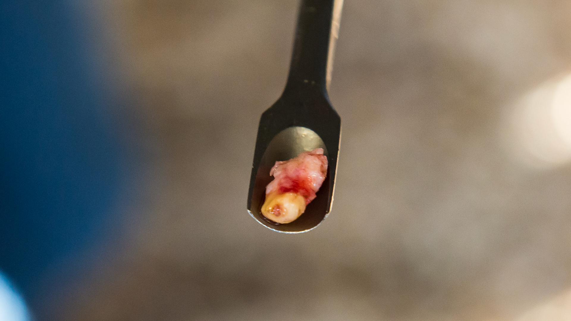 Wolf tooth extraction in an older horse. the occlusal surface is facing you.