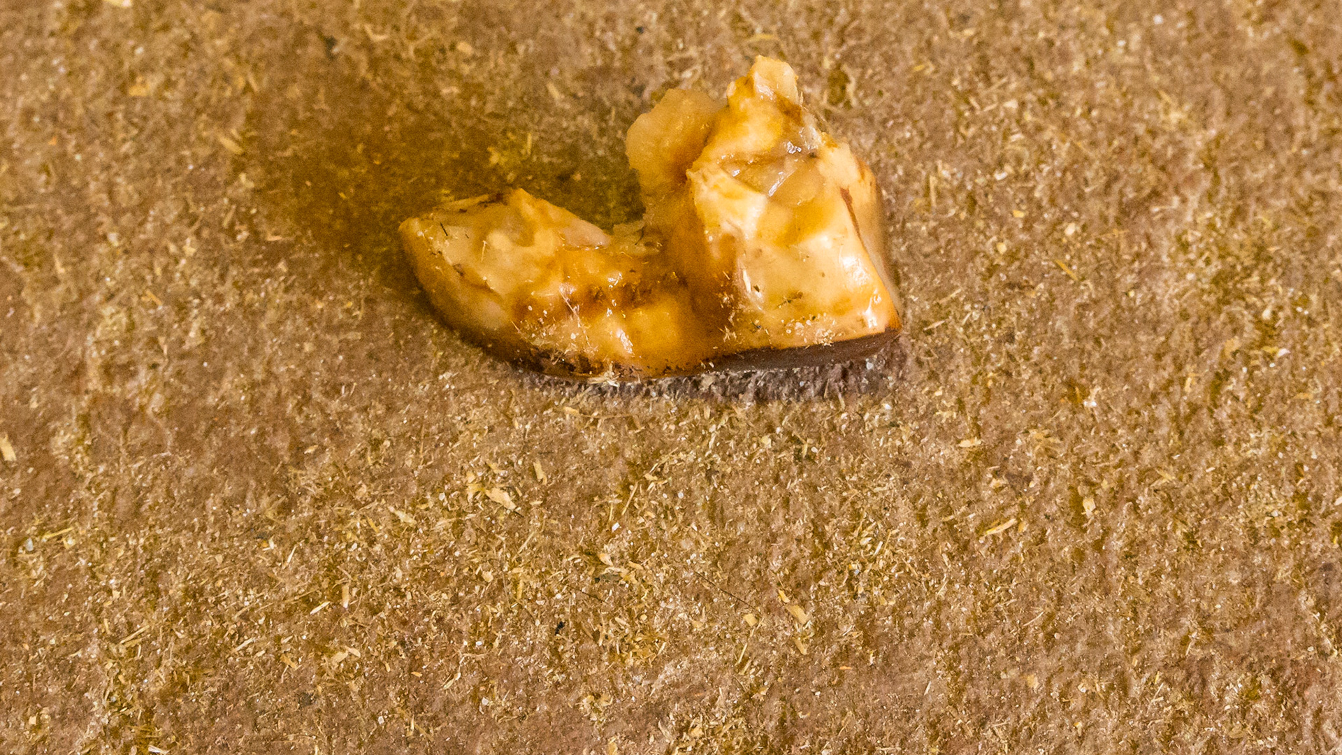 End stage #406 from a 28 year old