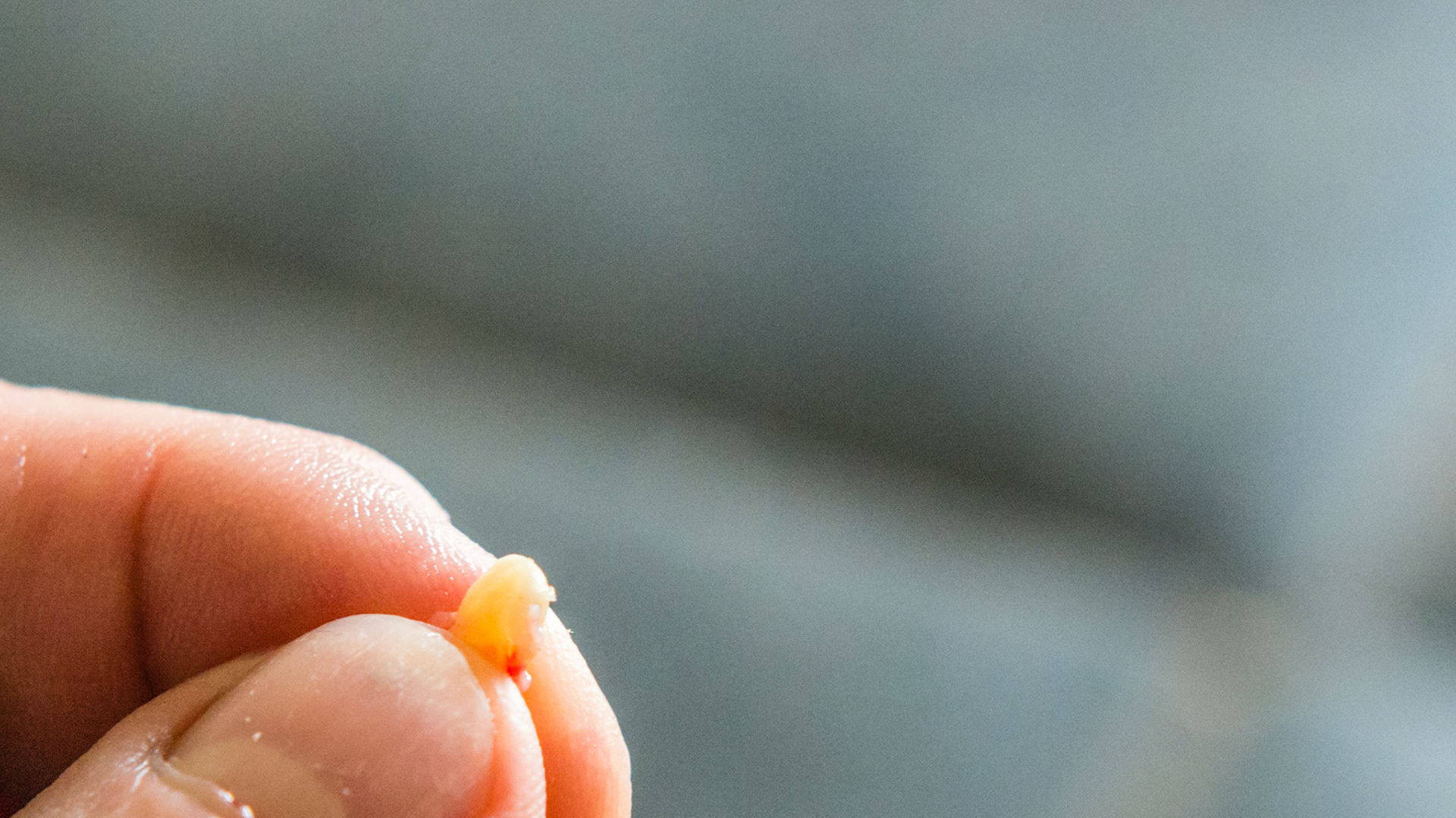 Wolf tooth #305 on the medial side of 306 - removed - 1 of 3 views.